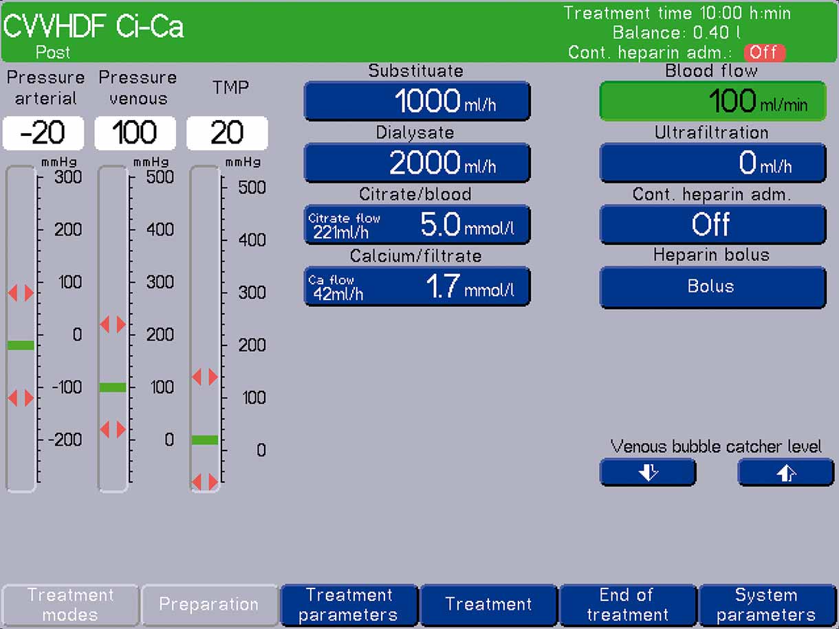 Configuración estándar para la CVVHDF posdilucional con multiFiltrate Ci-Ca®