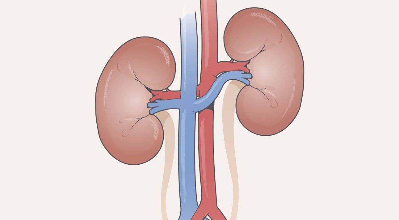 Enfermedad renal